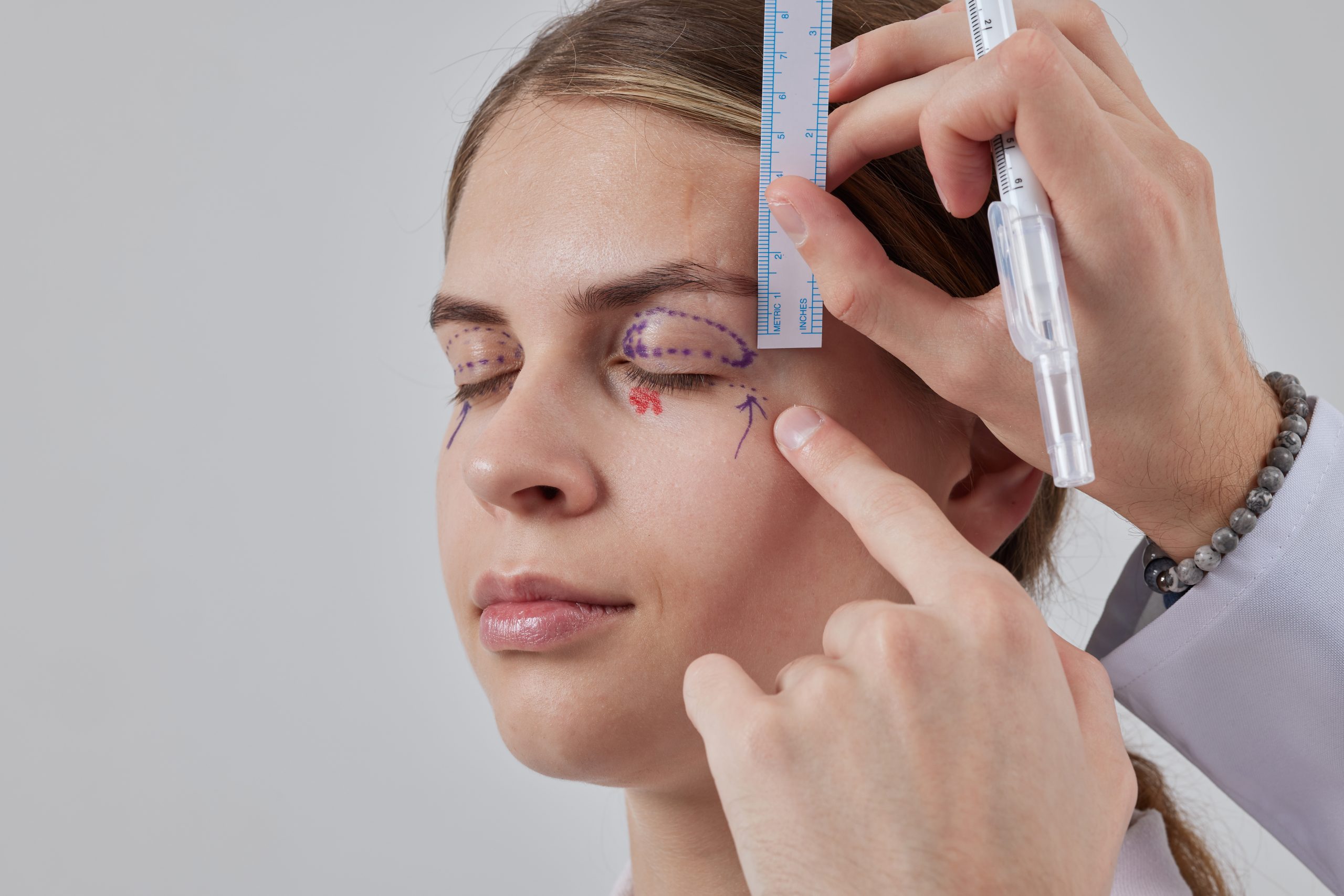 plastic surgeon prepares for blepharoplasty, blepharoplasty operation